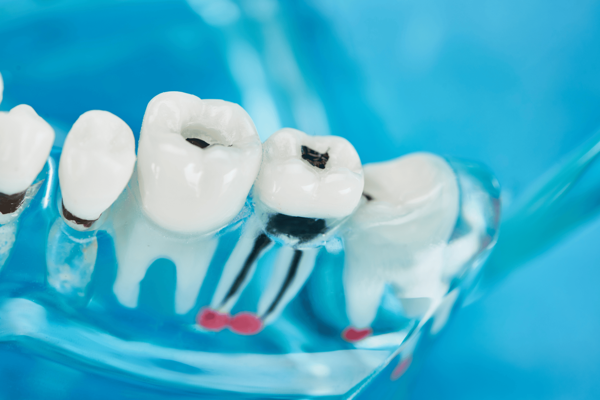 B2B dental tech PR marketing 17