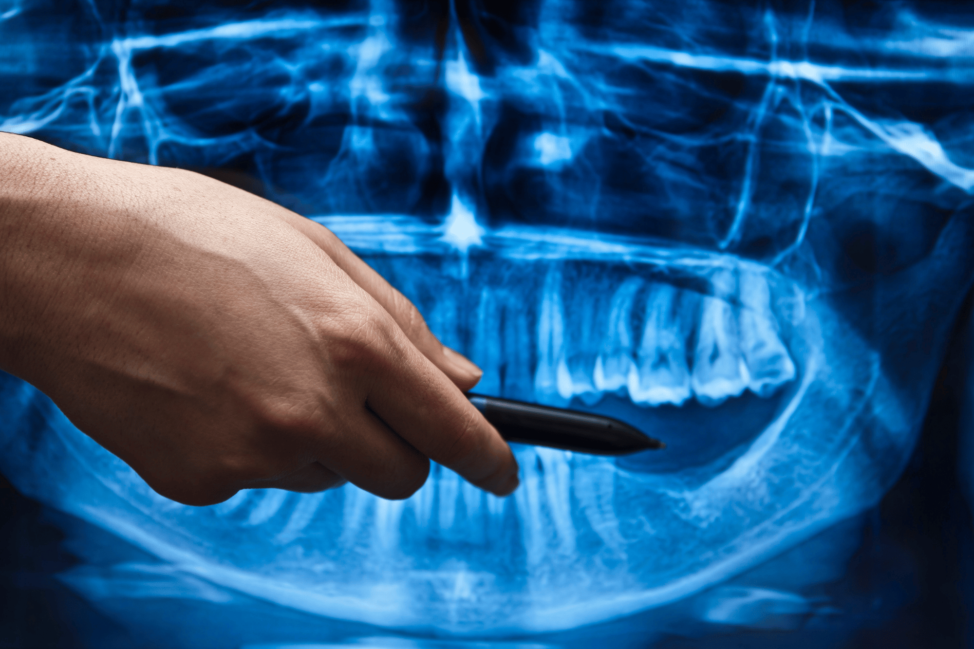 B2B dental tech PR marketing 22