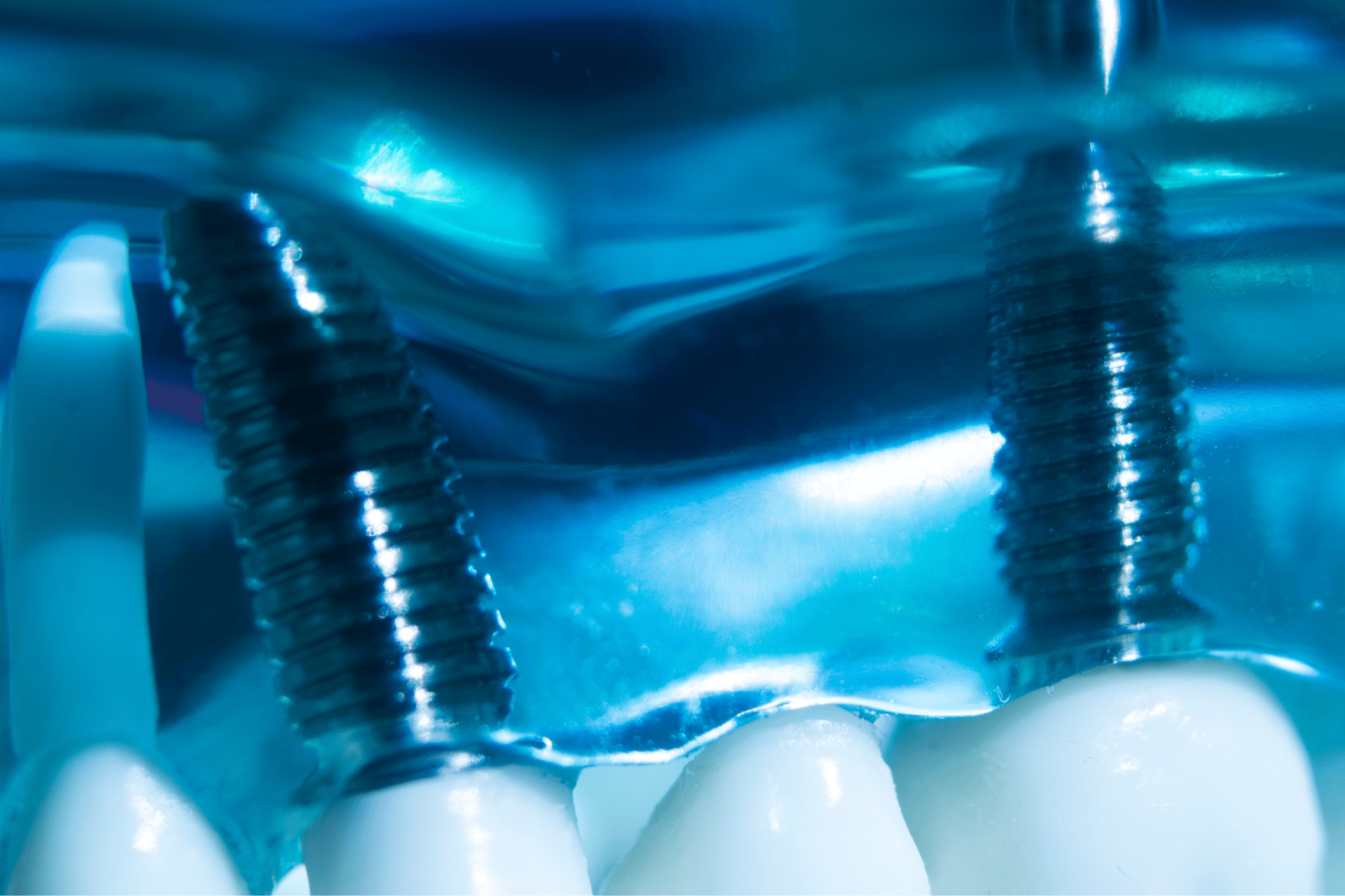 B2B dental tech PR marketing 3