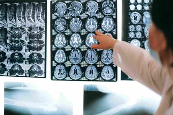  neuroplasticity and healthcare 