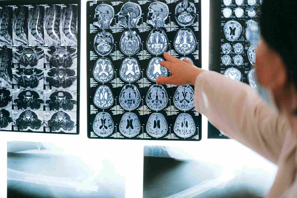 neuroplasticity and healthcare 